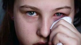 behcet-hastaligi-gozleri-vuruyor