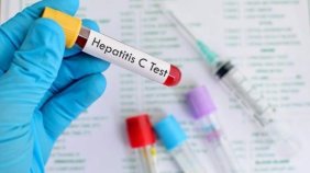 guzelleselim-derken-hepatit-c-kapmayin