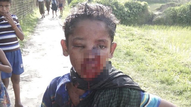 Soykırımcı Myanmar’a ilk darbe Türkiye’den geldi!