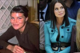 Ünlülerin estetiksiz halleri