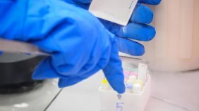 Soyağacı sitesiyle gerçek babasını öğrendi! Tüp bebek tedavisi uygulayan doktor...