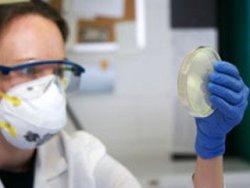 Fransa'da şarbon yüzünden 50 hayvan öldü