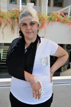 Kocasından dayak yiyen kadının kafasına 50 dikiş atıldı