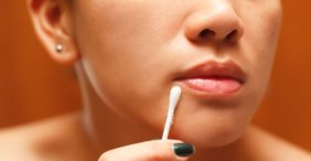 Buzla şoklayıp, diş fırçası ile işi bitirin