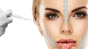 V estetiğiyle ameliyatsız yüz germe