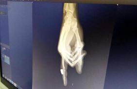 Balkonda oturan kadının parmağına kurşunu isabet etti