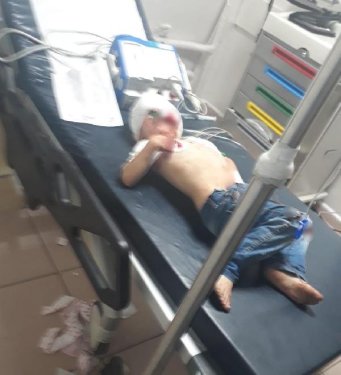 Batman’da evde patlama: 2’si ağır, 4 çocuk zarar görmüş