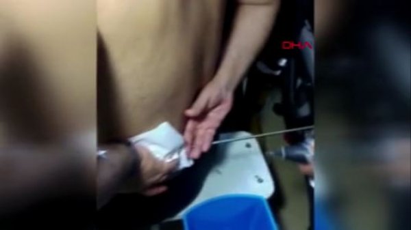 Balık yerine zıpkınla arkadaşını yaraladı