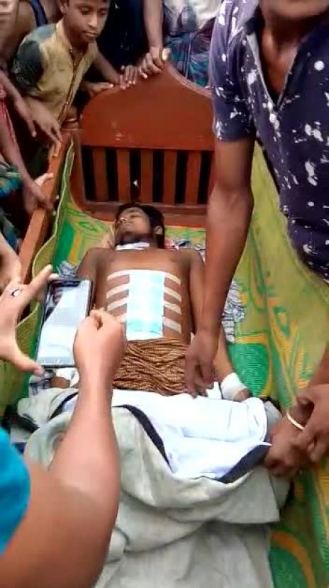 Bangladeş'te Arakanlı Müslümanın organları çalındı