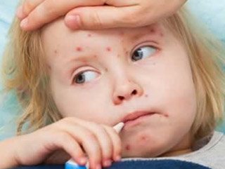 Avrupa'da kızamık artıyor