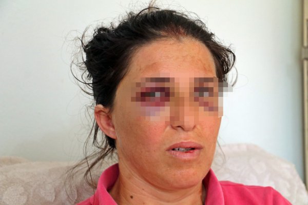 Çocuklarının yanında eşini darbetti
