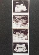 50 yaşındaki kadın, en yaşlı dördüz annesi olacak