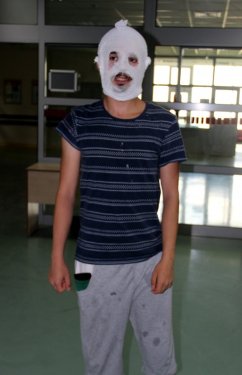 Merdiven altı krem yüzünü yaktı