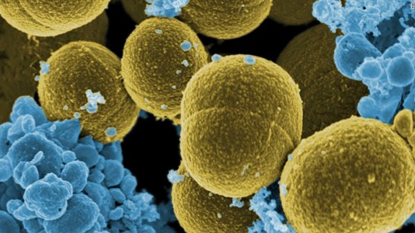 Antibiyotiklere dirençli süper bakteri yayılıyor