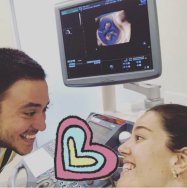 Pelin Akil, tek yumurta ikizlerini dünyaya getirecek