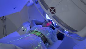 Radyoterapi nedir? Radyoterapi esnasında neler hissedilir?