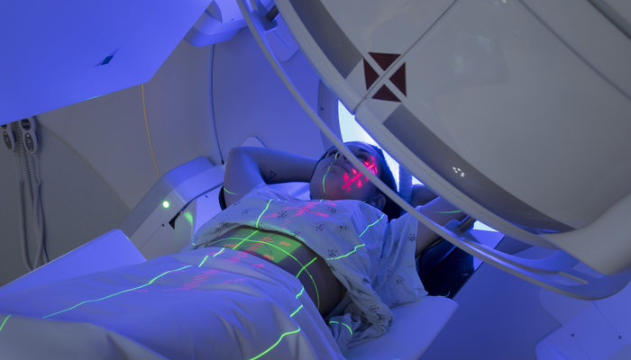 Radyoterapi nedir? Radyoterapi esnasında neler hissedilir?
