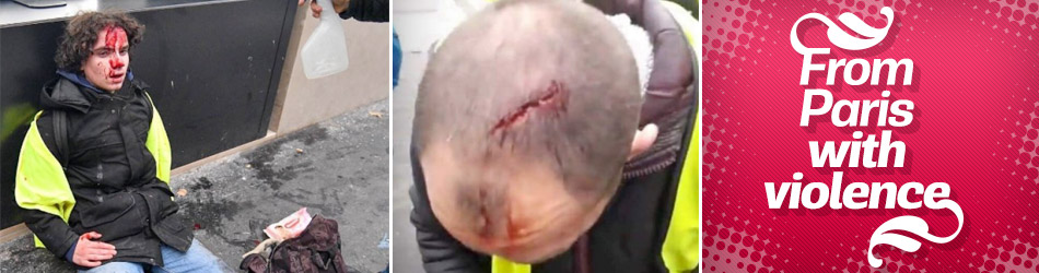 Kaos Paris polisi şiddete dönüştü