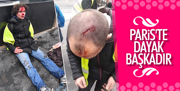 Fransa’da çatışmalar polis şiddetine dönüştü