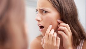 En sık görülen cilt sorunu nedir? Akne, cilt lekesi ve sarkma sorununda ne yapılmalı?