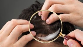 Mevsimsel saç dökülmesi nedir? Kışın saç dökülmesini durdurmak için ne yapmalıyız?