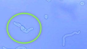 Uzmanlar uyarıyor! Eğer siz de bunları görüyorsanız dikkat