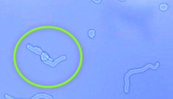 Uzmanlar uyarıyor! Eğer siz de bunları görüyorsanız dikkat