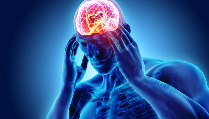 Migrene ne iyi kazanç? Migren belirtileri nelerdir? Migren en ivedi nasıl geçer?